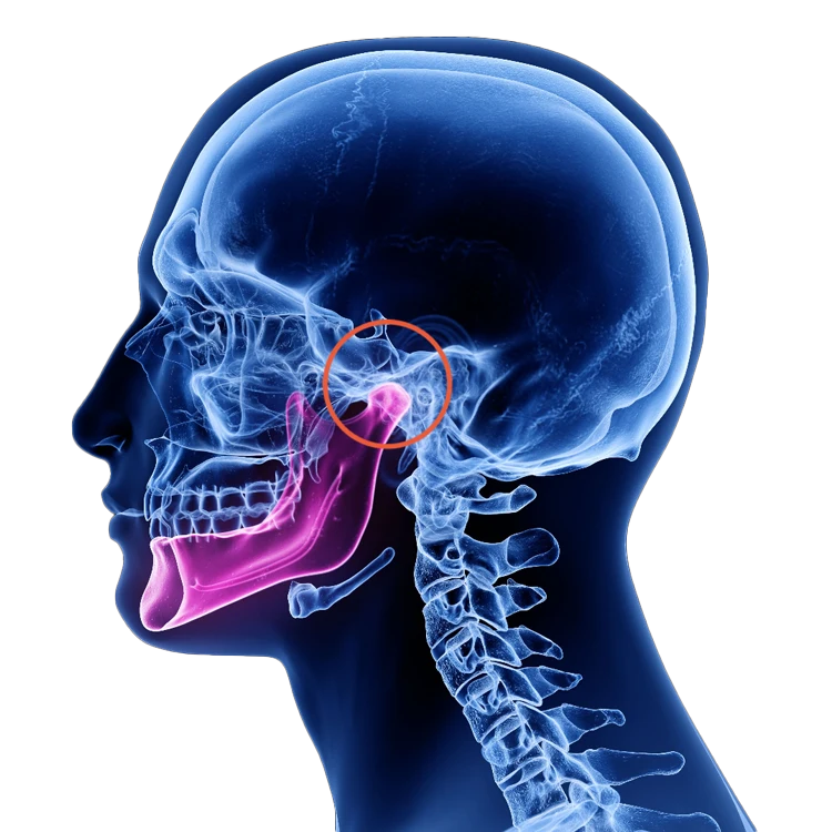 x-ray of the skull highlighting the TMJ